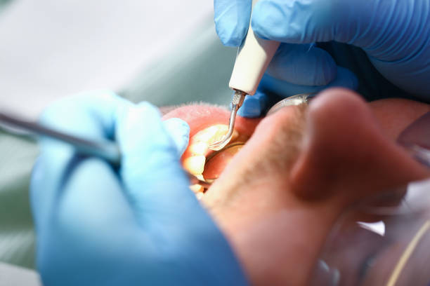Best Emergency Dental Surgery in Scottsburg, IN