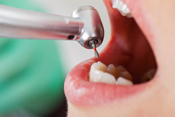 Best Emergency Treatment for Toothache in Scottsburg, IN